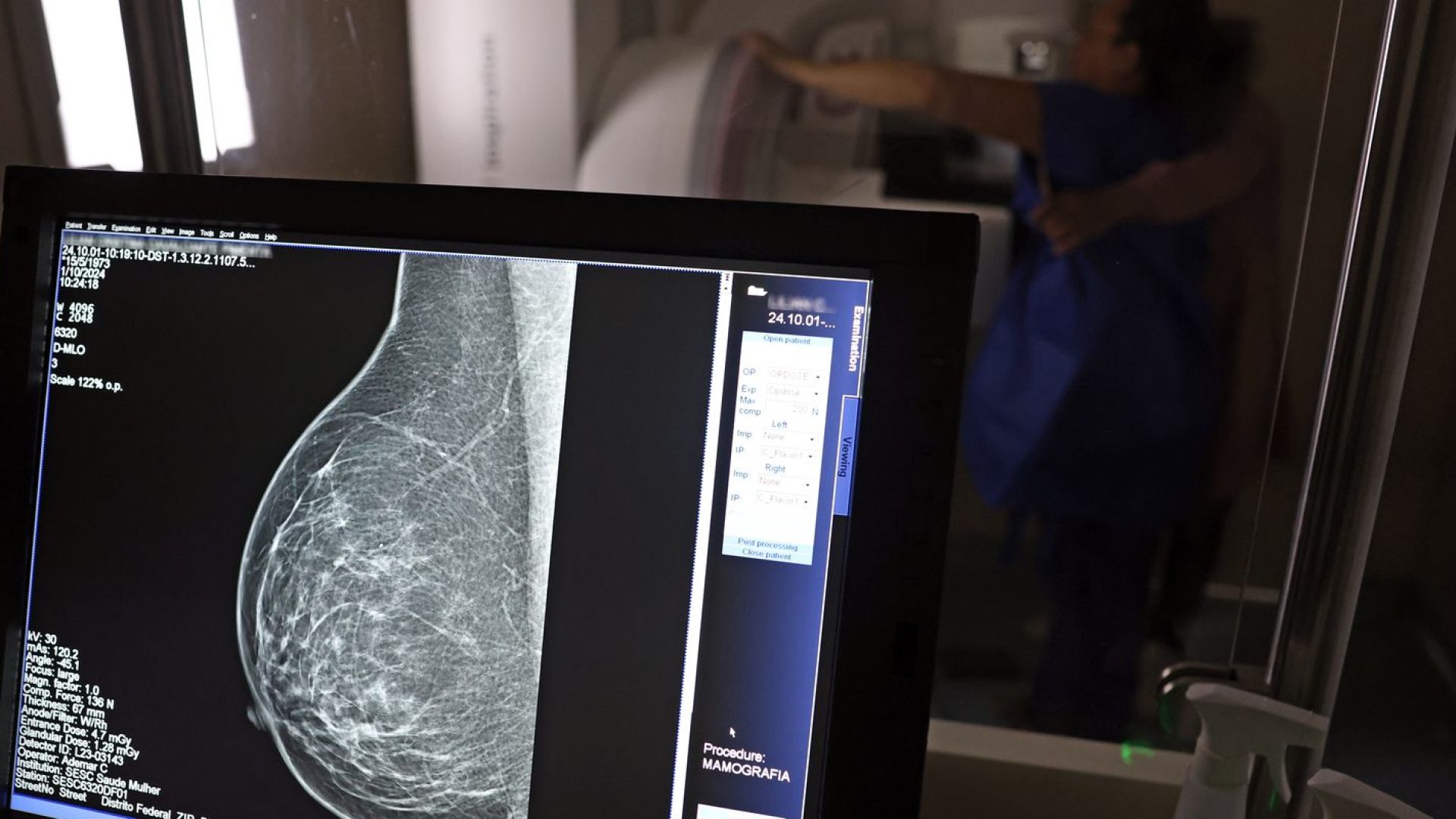 Plano de saúde terá que cobrir mamografia digital para todas as idades