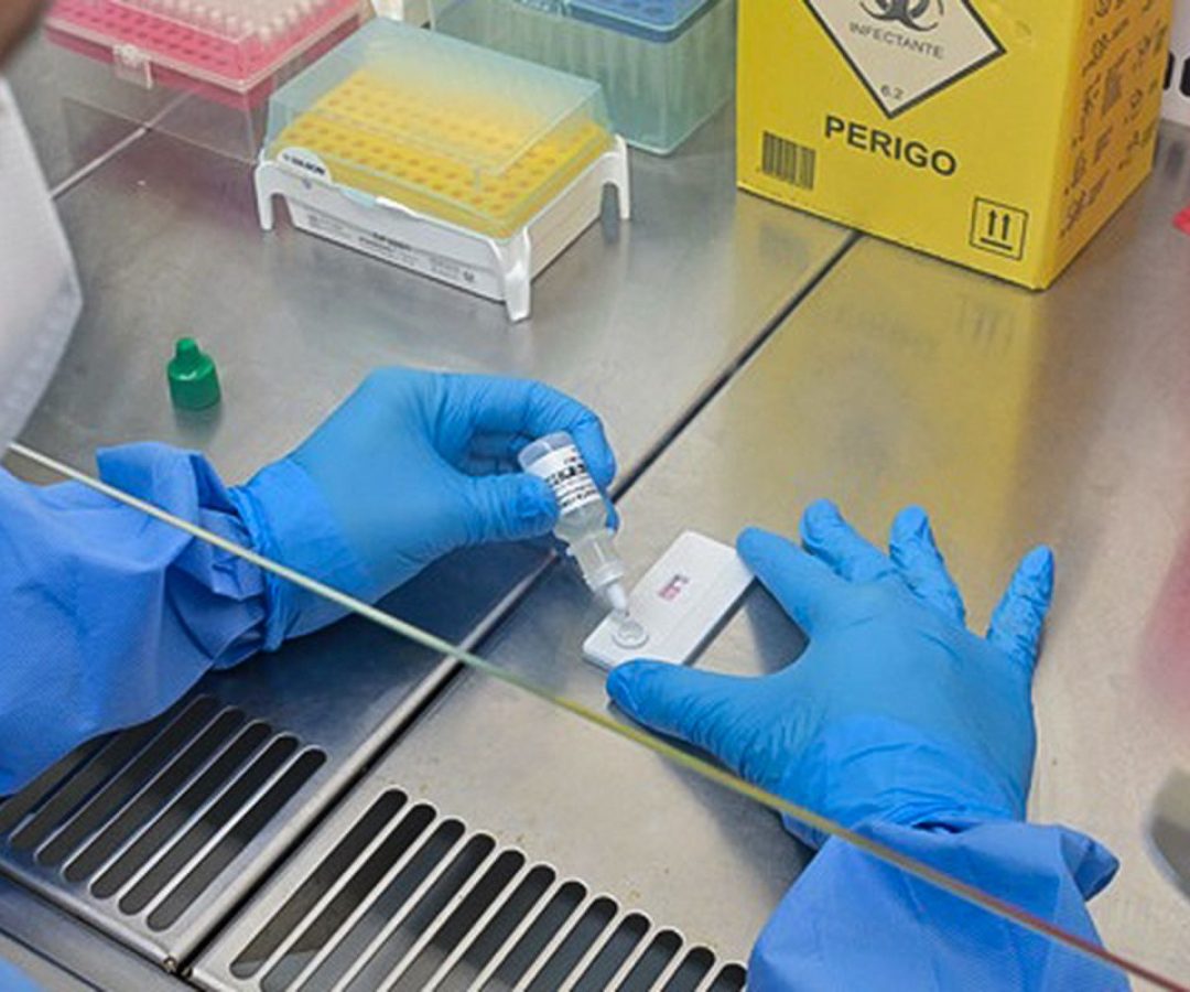 Anvisa atualiza regras sobre controle de qualidade em laboratórios