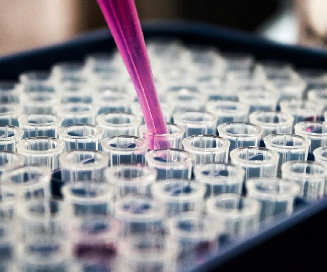 Diagnóstico precoce da AME é divisor de águas para qualidade de vida